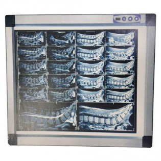 Wellton Healthcare X-Ray View Box Single Slim Digital With Sensor & Dimming Function WH-1833 Wellton Healthcare X-Ray View Box Single Slim Digital With Sensor & Dimming Function WH-1833