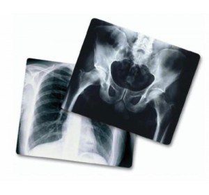 Wellton Healthcare X-Ray Film WH-1826