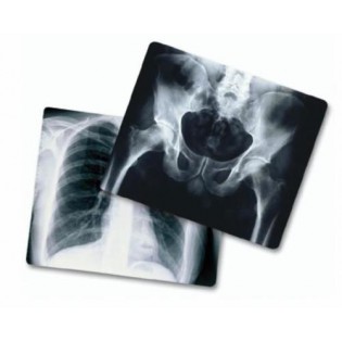 Wellton Healthcare X-Ray Film WH-1826 Wellton Healthcare X-Ray Film WH-1826