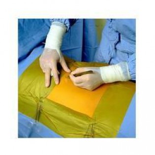 3M™ IOBAN™ ANTIMICROBIAL INCISE DRAPES 3M™ IOBAN™ ANTIMICROBIAL INCISE DRAPES
