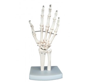 Wellton Healthcare Hand Joint Medical Models