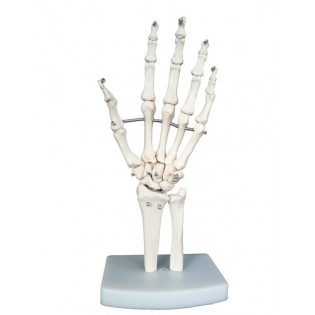 Wellton Healthcare Hand Joint Medical Models