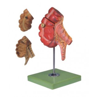 Wellton Healthcare Appendix and Caecum Medical Models