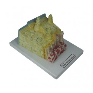 Wellton Healthcare Bone Microstructure Medical Models