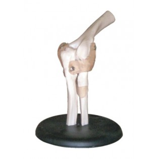 Wellton Healthcare Elbow Joint Medical Models