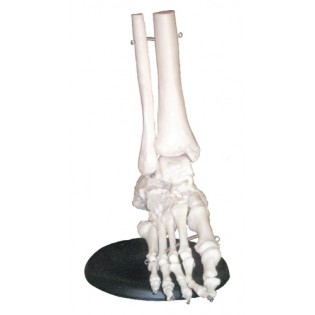 Wellton Healthcare Foot Joint Medical Models