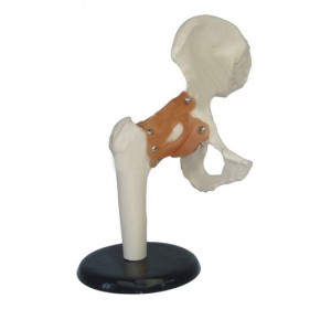 Wellton Healthcare Hip Joint Medical Models