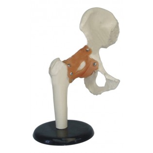 Wellton Healthcare Hip Joint Medical Models
