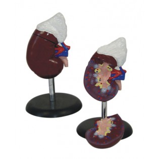 Wellton Healthcare Human Kidney with Adrenal Gland Medical Models
