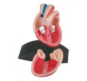 Wellton Healthcare Heart Medical Models