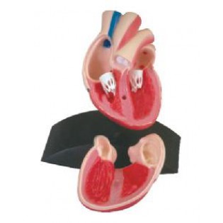 Wellton Healthcare Heart Medical Models