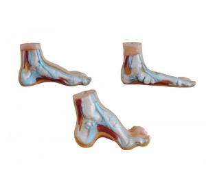 Wellton Healthcare Normal, Flat and Arched Foot Medical Models