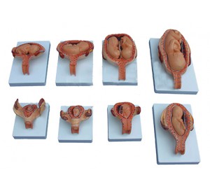 Wellton Healthcare The Development Process of Fetus Medical Models