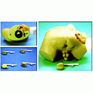 Wellton Healthcare Prostate Inspection Medical Models Wellton Healthcare Prostate Inspection Medical Models