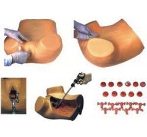 Wellton Healthcare Gynaecological Examination Medical Models