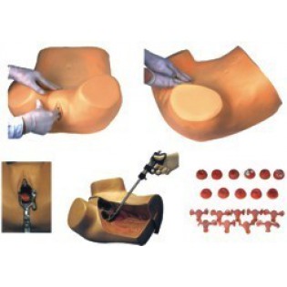 Wellton Healthcare Gynaecological Examination Medical Models